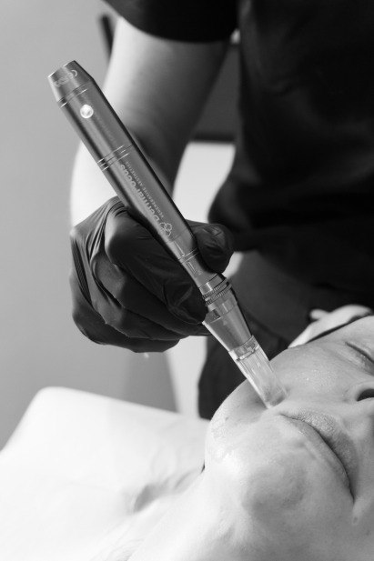 B&W Dermafocus Cheek