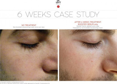 Dr LEVY Before and After Booster Serum