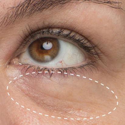 Daily Hydro-Drops Rejuvenating Eye Gel Cream - Before & After 1