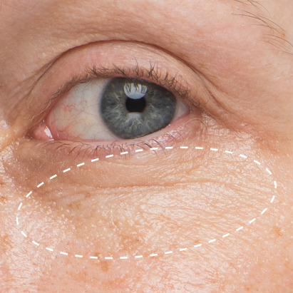 Daily Hydro-Drops Rejuvenating Eye Gel Cream - B&A 2