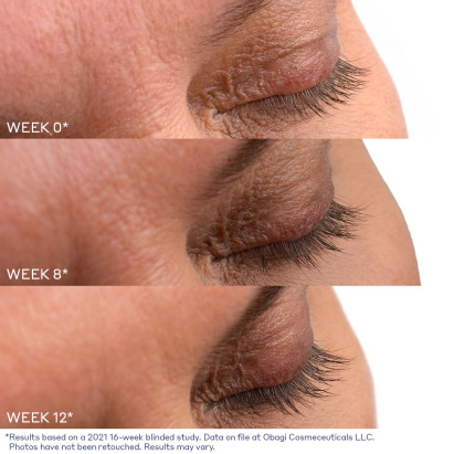 Nu-Cil Eyelash Enhancing Serum - Before & Afters
