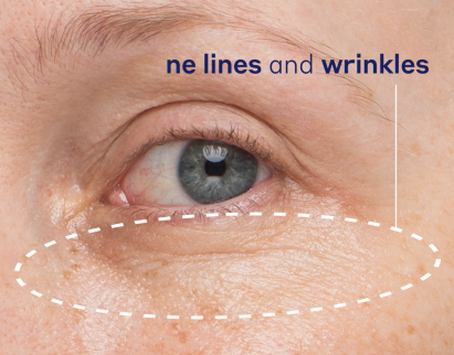 Daily Hydro-Drops Rejuvenating Eye Gel Cream - Before & After Reel 2