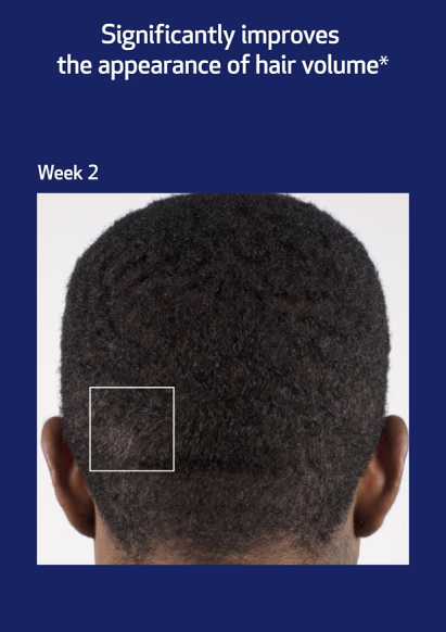 NEW Nu-Cil Biostim Scalp Serum - B&A Reel 2