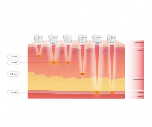 How does ULTRAcel Q+ work?