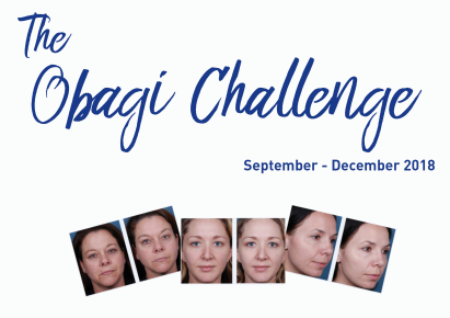 Obagi Nu-Derm Fx - Before and Afters