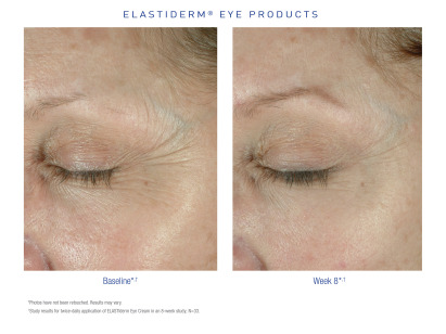 ELASTIderm Before and After 2