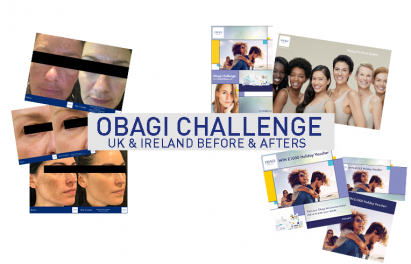 Obagi Challenge Before & After Photos - ELASTIderm