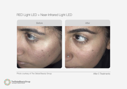 MediLUX Before & Afters