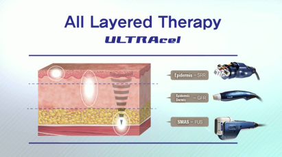 ULTRAcel