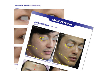 Before and After Databook 1